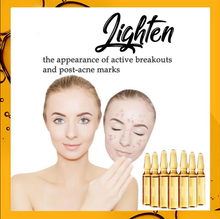 Load image into Gallery viewer, Pigment Zero Niacinamide Ampoule
